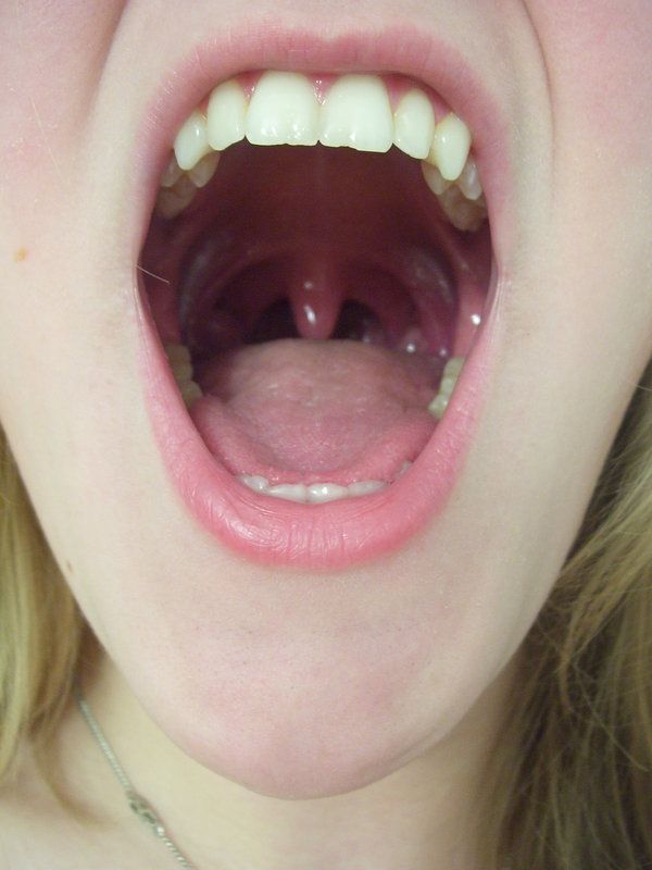 pic Mouth Reference Real lips anatomy teeth mouth reference